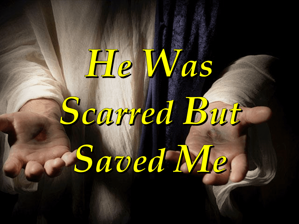 He Was Scarred But Saved Me